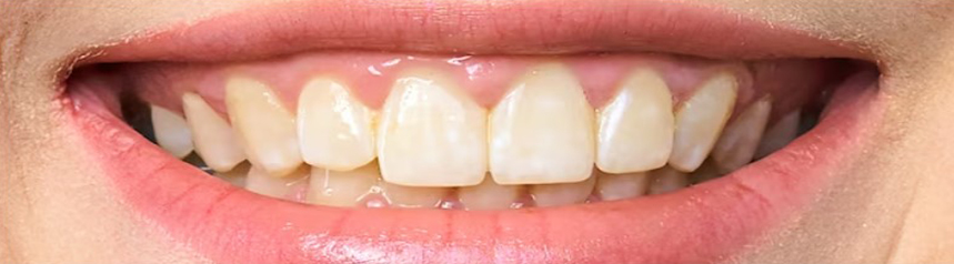 Success Stories Before & After Treatment